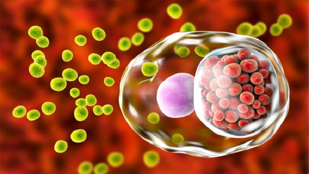 Tổng quan về bệnh Chlamydia: Các dấu hiệu và triệu chứng