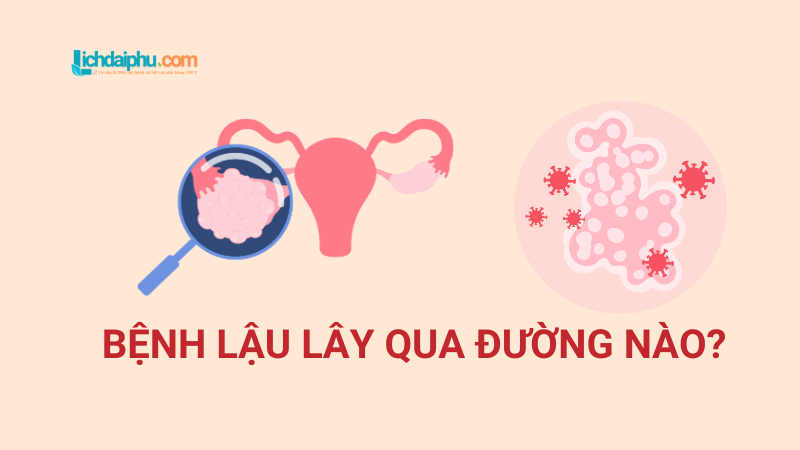 Bệnh Lậu Lây Qua Đường Nào? Nguyên Nhân, Triệu Chứng và Cách Phòng Ngừa