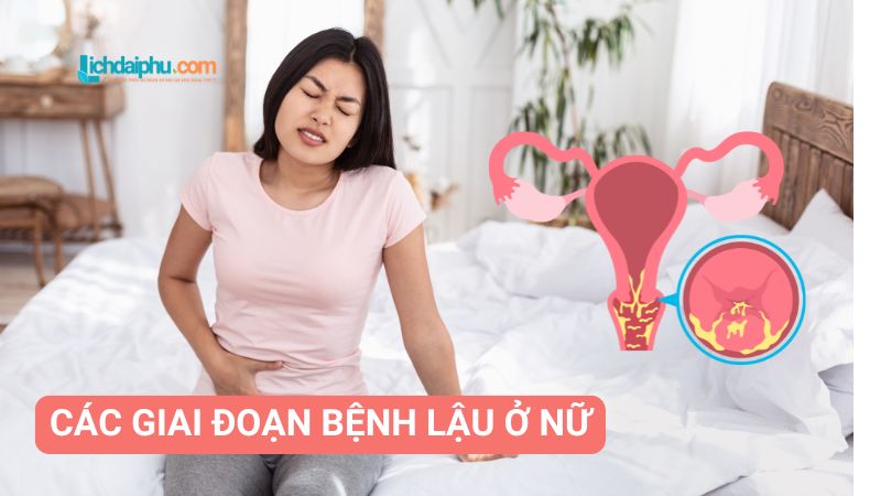 Các giai đoạn bệnh lậu ở nữ: Triệu chứng, điều trị, phòng ngừa