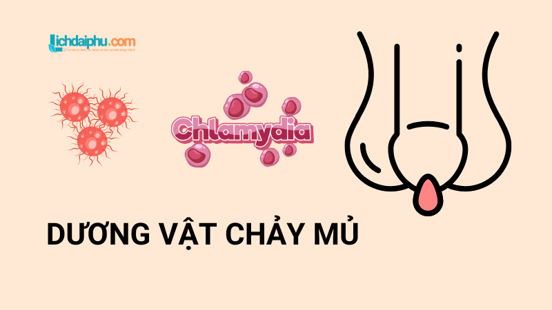 Dương Vật Chảy Mủ: Nguyên Nhân, Triệu Chứng Và Cách Điều Trị