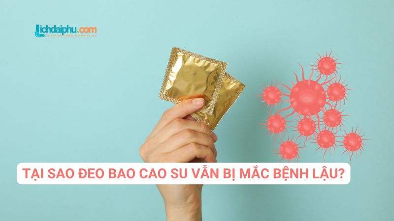 Tại sao đeo bao cao su khi quan hệ nhưng vẫn bị mắc bệnh lậu?