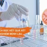 Hình ảnh vi khuẩn lậu Neisseria gonorrhoeae có hình hạt cà phê nằm trong bạch cầu đa nhân