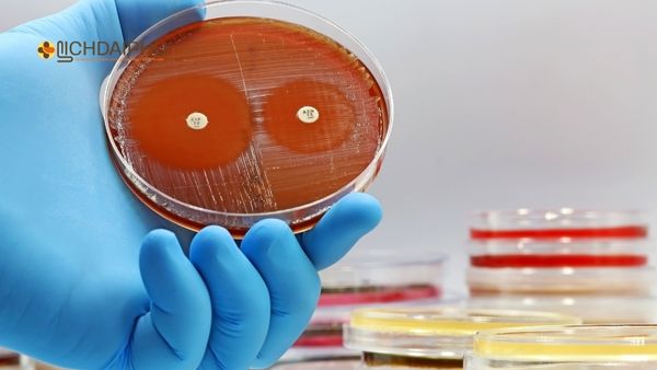 Vi khuẩn lậu kháng thuốc – Thách thức lớn trong điều trị bệnh lậu hiện nay Hình ảnh vi khuẩn lậu kháng thuốc được nuôi cấy trong phòng thí nghiệm, cho thấy khả năng đề kháng kháng sinh cao gây khó khăn trong điều trị bệnh lậu.