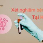 Hình ảnh minh họa vi khuẩn lậu và tiêu đề “Xét nghiệm bệnh lậu ở đâu chính xác tại Hà Nội?” dùng cho bài viết hướng dẫn địa chỉ xét nghiệm bệnh lậu chính xác, uy tín tại Hà Nội.