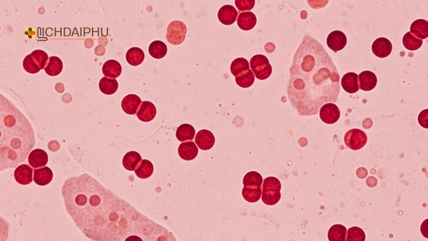 Dương vật chảy mủ do bệnh lậu hình ảnh song cầu lậu