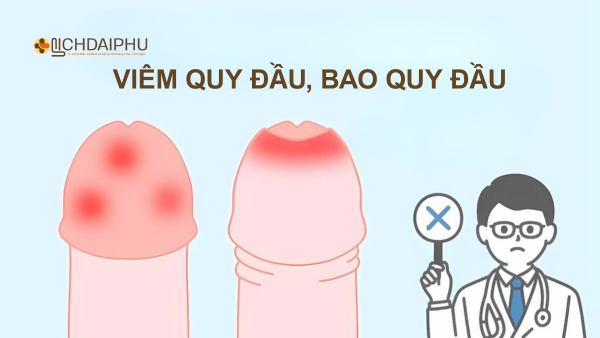 Dương vật chảy mủ do viêm bao quy đầu viêm quy đầu